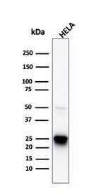 HSP27 (Heat Shock Protein 27) Antibody in Western Blot (WB)