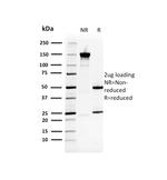 Heat Shock 27kDa Protein 1 Antibody in SDS-PAGE (SDS-PAGE)