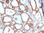 Heat Shock 27kDa Protein 1 Antibody in Immunohistochemistry (Paraffin) (IHC (P))