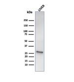 Heat Shock 27kDa Protein 1 Antibody in Western Blot (WB)