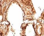 Heat Shock 27kDa Protein 1 Antibody in Immunohistochemistry (Paraffin) (IHC (P))