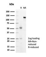 Heat Shock 27kDa Protein 1 Antibody in SDS-PAGE (SDS-PAGE)