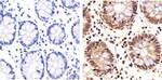 PLK1 Antibody in Immunohistochemistry (Paraffin) (IHC (P))