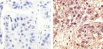 CDK1 Antibody in Immunohistochemistry (Paraffin) (IHC (P))