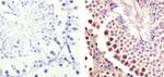 CDK1 Antibody in Immunohistochemistry (Paraffin) (IHC (P))