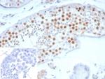 Survivin/BIRC5 Antibody in Immunohistochemistry (Paraffin) (IHC (P))