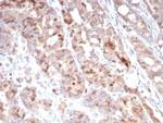 Survivin/BIRC5 Antibody in Immunohistochemistry (Paraffin) (IHC (P))