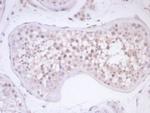 Survivin/BIRC5 Antibody in Immunohistochemistry (Paraffin) (IHC (P))