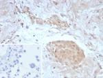 Survivin/BIRC5 Antibody in Immunohistochemistry (Paraffin) (IHC (P))