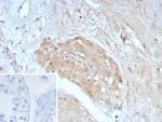 Survivin/BIRC5 Antibody in Immunohistochemistry (Paraffin) (IHC (P))