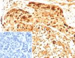 Survivin/BIRC5 Antibody in Immunohistochemistry (Paraffin) (IHC (P))