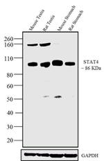 STAT4 Antibody in Western Blot (WB)