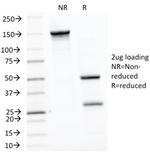 HSP60 (Heat Shock Protein 60) (Mitochondrial Marker) Antibody in SDS-PAGE (SDS-PAGE)