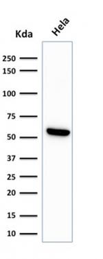 HSP60 (Heat Shock Protein 60) (Mitochondrial Marker) Antibody in Western Blot (WB)