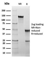 HSP60 (Heat Shock Protein 60) (Mitochondrial Marker) Antibody in SDS-PAGE (SDS-PAGE)