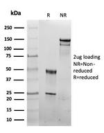 HSP60 (Heat Shock Protein 60) Antibody in SDS-PAGE (SDS-PAGE)