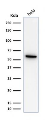 HSP60 (Heat Shock Protein 60) (Mitochondrial Marker) Antibody in Western Blot (WB)