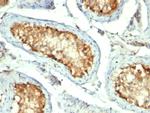 HSP60 (Heat Shock Protein 60) (Mitochondrial Marker) Antibody in Immunohistochemistry (Paraffin) (IHC (P))