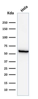 HSP60 (Heat Shock Protein 60) (Mitochondrial Marker) Antibody in Western Blot (WB)