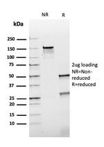 HSP60 (Heat Shock Protein 60) Antibody in SDS-PAGE (SDS-PAGE)