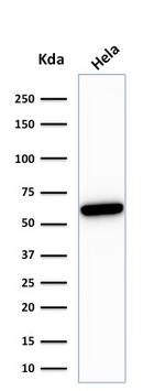 HSP60 (Heat Shock Protein 60) Antibody in Western Blot (WB)