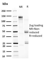 HSP60 (Heat Shock Protein 60) Antibody in SDS-PAGE (SDS-PAGE)