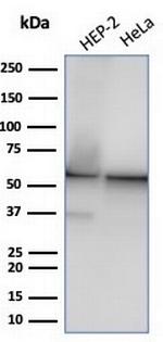 HSP60 (Heat Shock Protein 60) (Mitochondrial Marker) Antibody in Western Blot (WB)