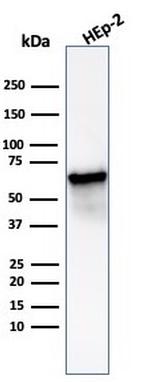 HSP60 (Heat Shock Protein 60) Antibody in Western Blot (WB)