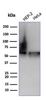 HSP60 (Heat Shock Protein 60) Antibody in Western Blot (WB)