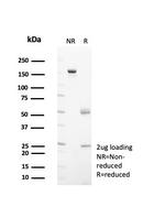 HSP60 (Heat Shock Protein 60) (Mitochondrial Marker) Antibody in SDS-PAGE (SDS-PAGE)