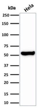 HSP60 (Heat Shock Protein 60) Antibody in Western Blot (WB)