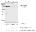 Phospho-STAT1 (Tyr701) Antibody in Western Blot (WB)