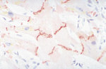 N-cadherin Antibody in Immunohistochemistry (IHC)