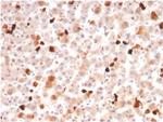 Apolipoprotein A1/APOA1 Antibody in Immunohistochemistry (Paraffin) (IHC (P))