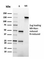 Apolipoprotein A1/APOA1 Antibody in SDS-PAGE (SDS-PAGE)