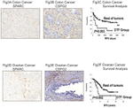 SPARC Antibody in Immunohistochemistry (IHC)