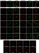 Connexin 26 Antibody in Immunocytochemistry (ICC/IF)