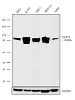 STAT5 alpha/beta Antibody in Western Blot (WB)