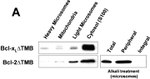 Bcl-2 Antibody in Western Blot (WB)