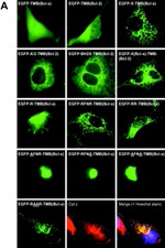 Bcl-2 Antibody in Immunocytochemistry (ICC/IF)