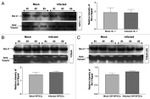 Bcl-2 Antibody in Western Blot (WB)