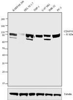 CD44v6 Antibody in Western Blot (WB)