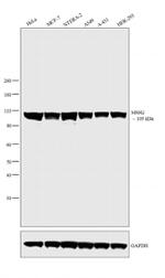 MSH2 Antibody in Western Blot (WB)