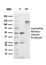 Apolipoprotein B /APOB Antibody in SDS-PAGE (SDS-PAGE)