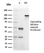 Apolipoprotein B/APOB Antibody in Immunoelectrophoresis (IE)