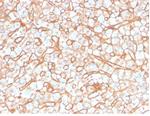 Apolipoprotein B/APOB Antibody in Immunohistochemistry (Paraffin) (IHC (P))