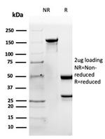 Apolipoprotein B/APOB Antibody in Immunoelectrophoresis (IE)