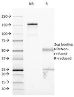 CD54/ICAM-1 Antibody in SDS-PAGE (SDS-PAGE)