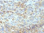 CD54/ICAM-1 Antibody in Immunohistochemistry (Paraffin) (IHC (P))