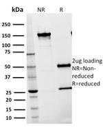 CD54/ICAM-1 Antibody in SDS-PAGE (SDS-PAGE)